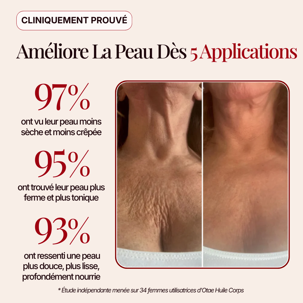 Otae® Huile de Corps