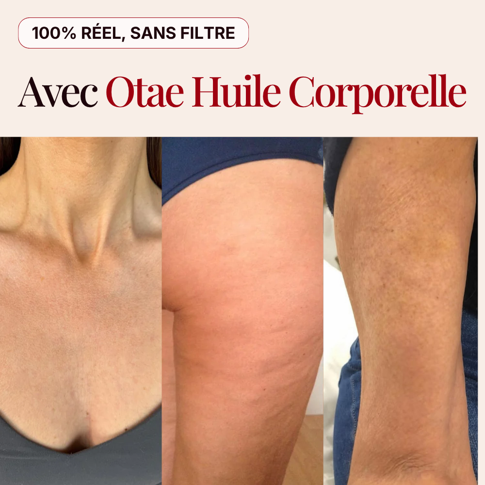 Otae® Huile de Corps