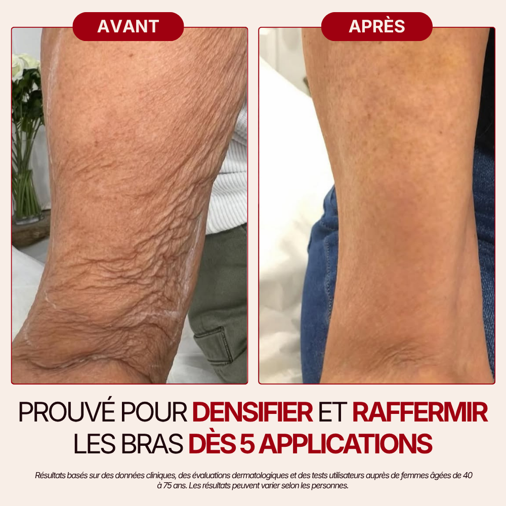 Otae® Huile de Corps