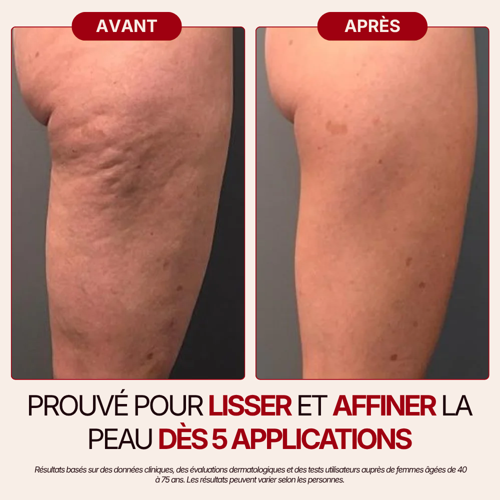 Otae® Huile de Corps