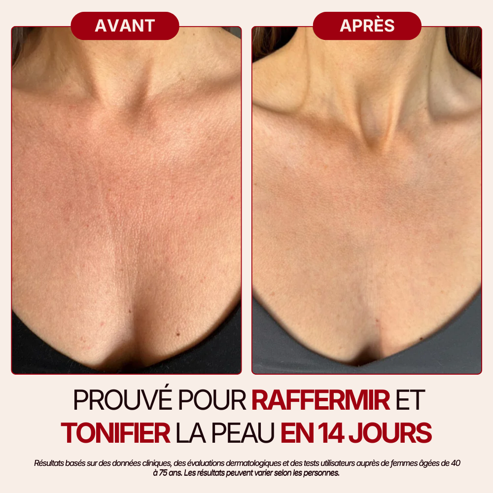 Otae® Huile de Corps