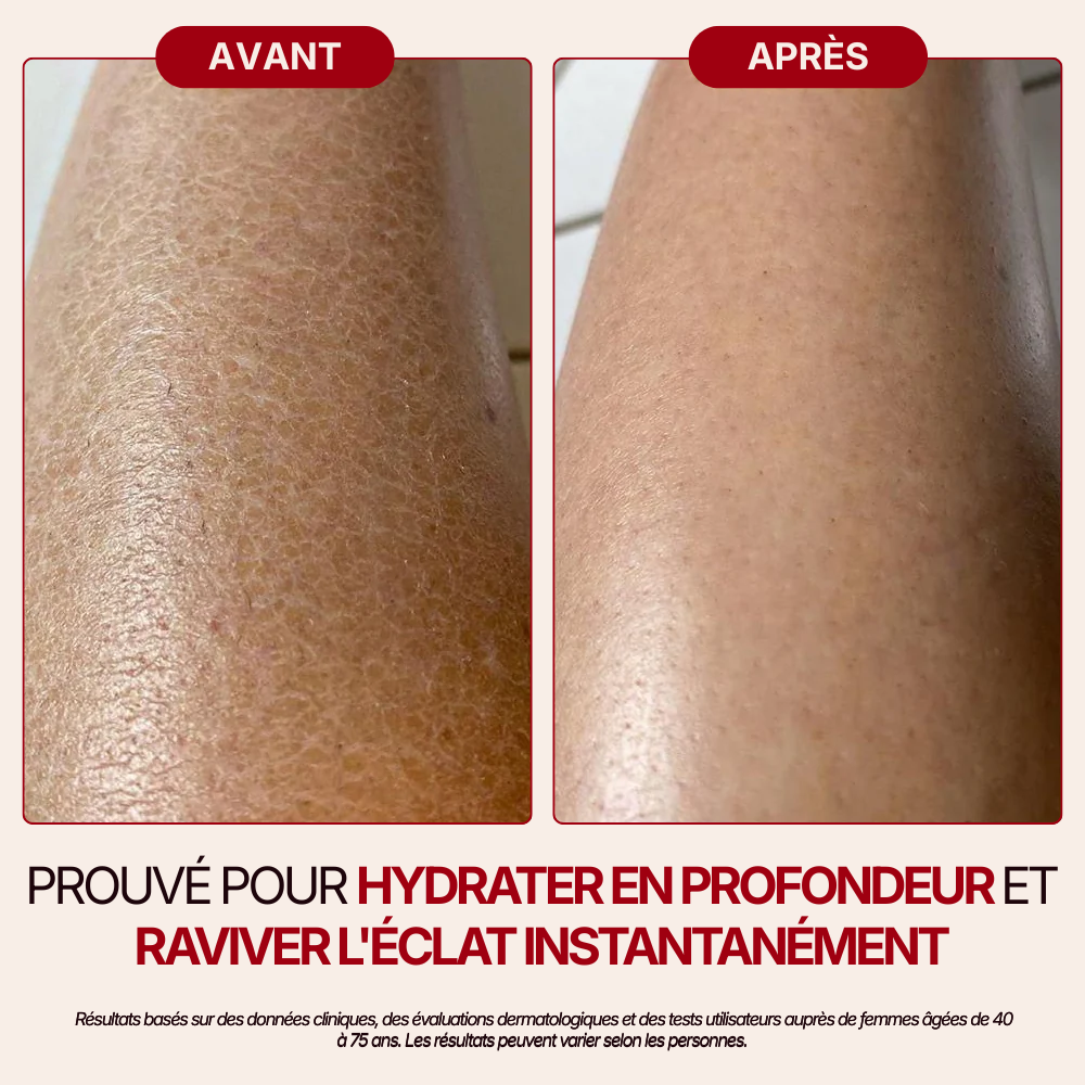 Otae® Huile de Corps